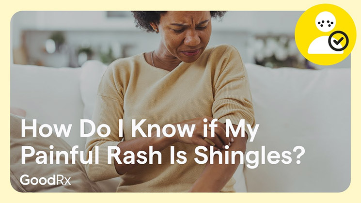 Photo of patient with shingles rash