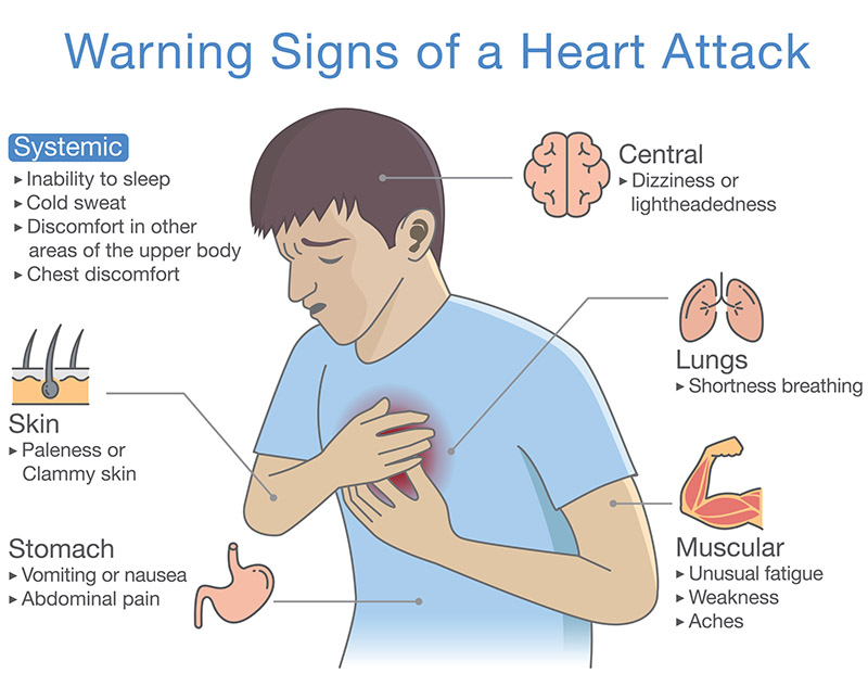 What Does Heart Attack Pain Feel Like In Woman