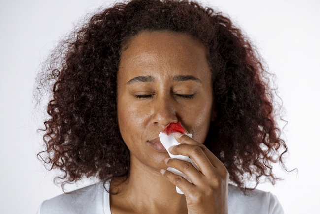 Stock photo: Woman With Nosebleed. Photo by solidcolours/Getty Images