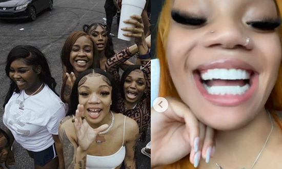 GloRilla gets a shoutout from Cardi B after getting her teeth fixed