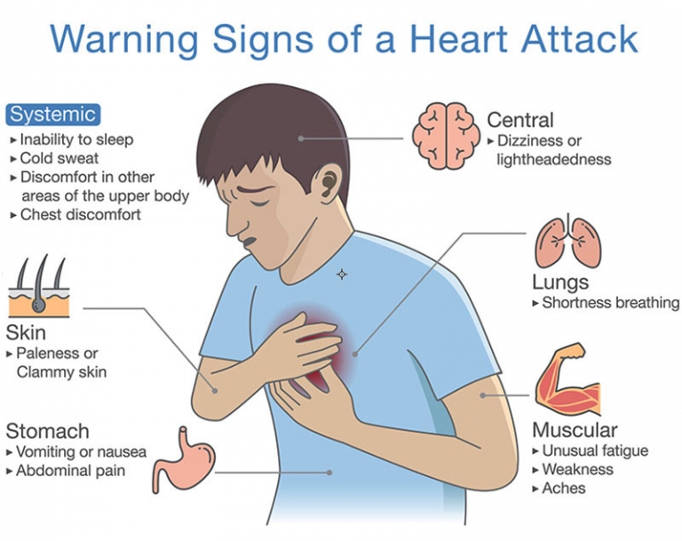 Stock Diagram about warning signs of a heart attack. Illustration about ...