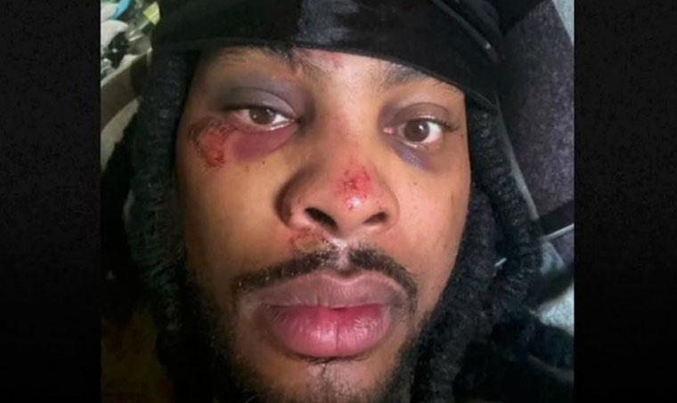 Waka Flocka called out for posting fake photo of ambush attack