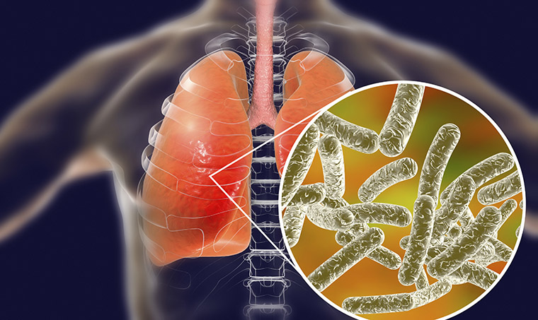 Legionnaires’ disease outbreak in NYC kills three, sickens 70