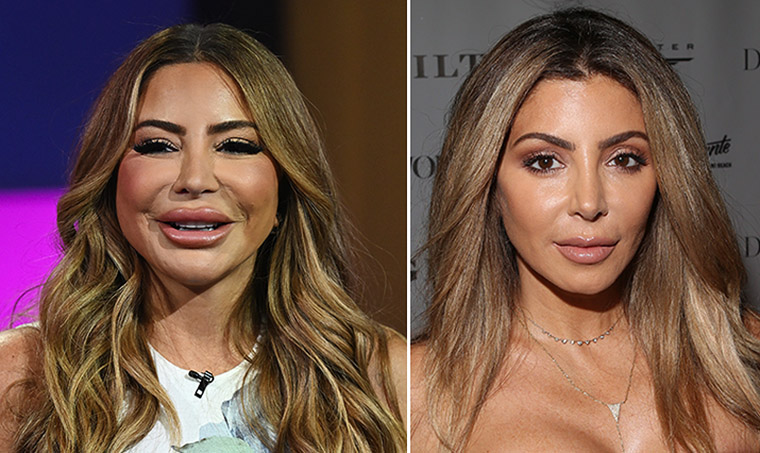 Larsa Pippen claps back at doctors who claim she had facelift (‘It’s an allergic reaction’)