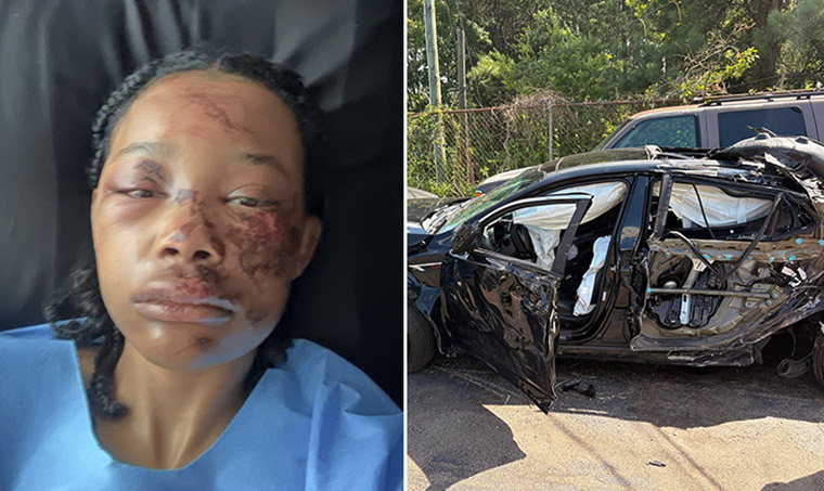 Lesbian Couple, Chased by Racists, Suffer Injuries in Car Crash: ‘Beyond Grateful to be Alive’
