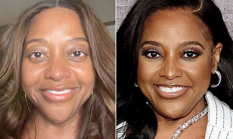 Sherri Shepherd Fires Back After Doctor Says She Needs a Facelift
