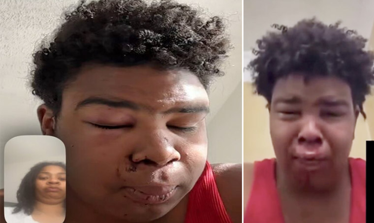 Boy who busted mom’s car window with rocks was placed in foster care. Now he’s crying