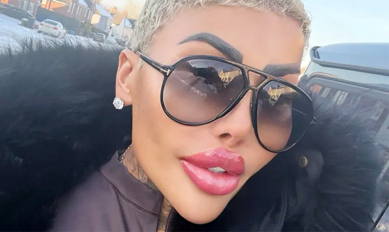 Kardashian-obsessed ‘Lip King’ died of botched BBL while on bail